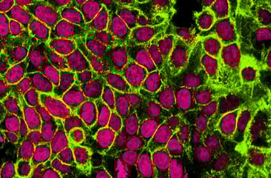 Thumbnail for 6774576