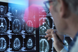 Thumbnail for 6797323