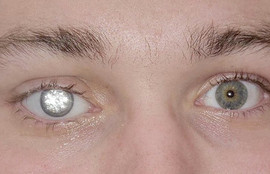 Thumbnail for 6805538