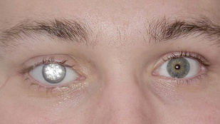 Thumbnail for 6805538