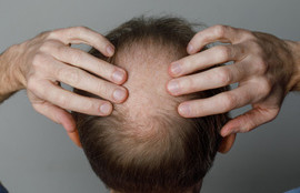 Thumbnail for 6807101