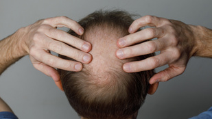 Thumbnail for 6807101