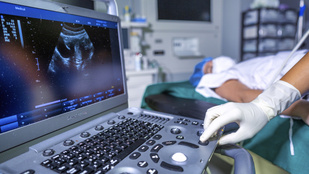 Thumbnail for 6811616