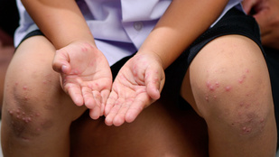 Thumbnail for 6813888