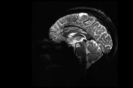 Thumbnail for 6820730