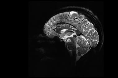 Thumbnail for 6820730