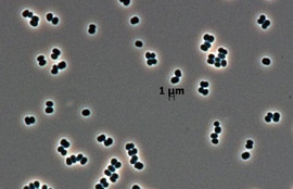 Thumbnail for 6825400