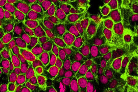 Thumbnail for 6827123