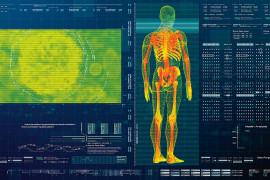 Thumbnail for 6830088