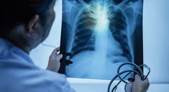 Thumbnail for 6834830