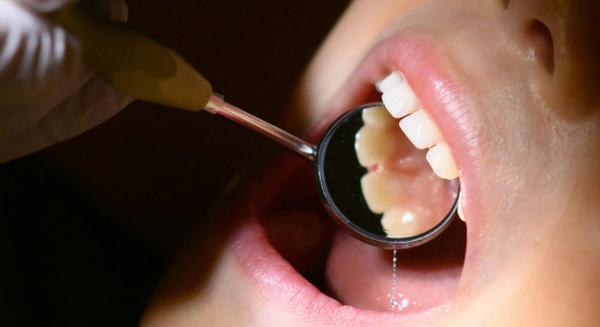 Thumbnail for 6847838