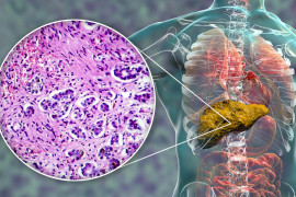 Thumbnail for 6848894