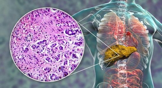 Thumbnail for 6848894