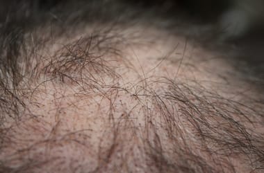 Thumbnail for 6860398