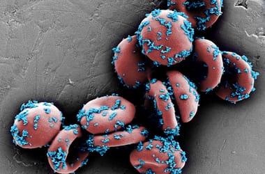 Thumbnail for 6871763