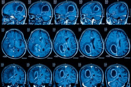 Thumbnail for 6884267