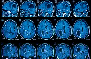 Thumbnail for 6884267