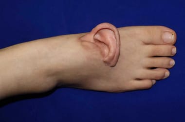 Thumbnail for 6886094