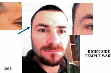 Thumbnail for 6888108