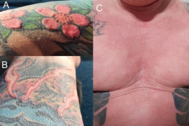 Thumbnail for 6905267