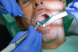 Thumbnail for 6919588