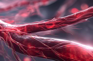 Thumbnail for 6935829