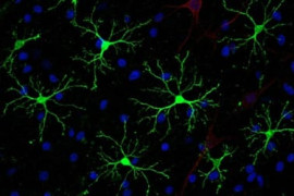 Thumbnail for 6935885