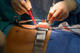 Thumbnail for 6936731