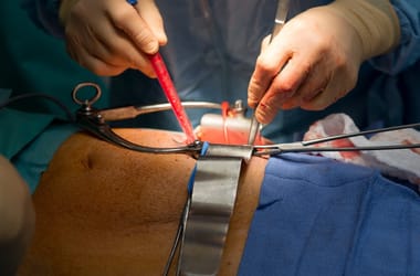 Thumbnail for 6936731