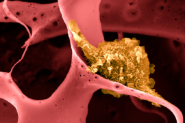 Thumbnail for 6946694