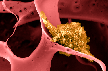 Thumbnail for 6946694