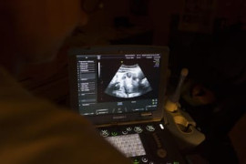 Thumbnail for 6975510