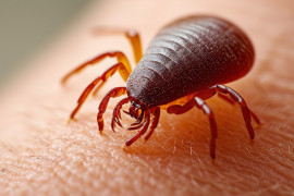 Thumbnail for 6985293