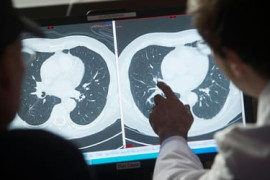 Thumbnail for 6986218