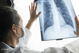 Thumbnail for 6992253