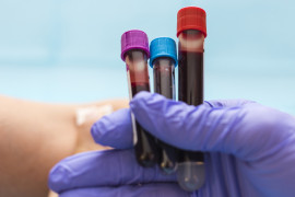 Thumbnail for 7007070