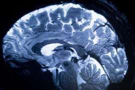 Thumbnail for 7009216