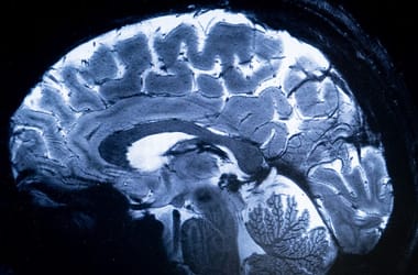 Thumbnail for 7009216