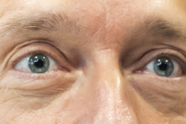 Thumbnail for 7027479