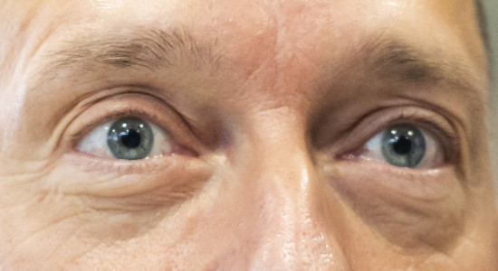 Thumbnail for 7027479