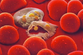 Thumbnail for 7055239