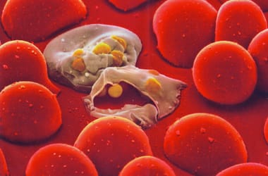 Thumbnail for 7055239